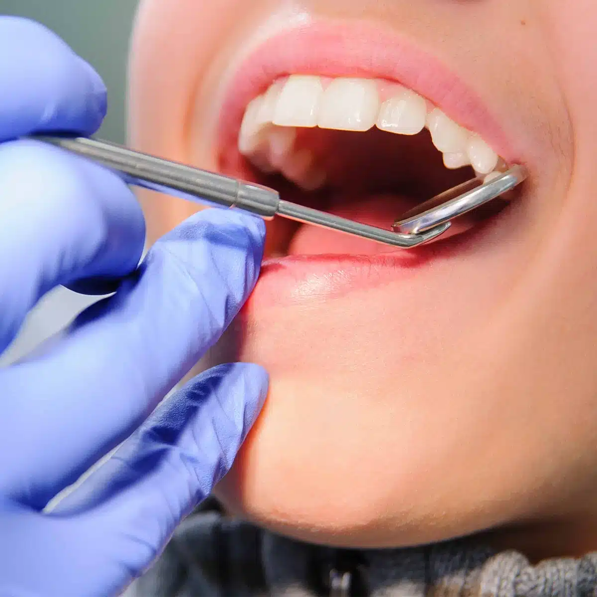 Dental Check Up