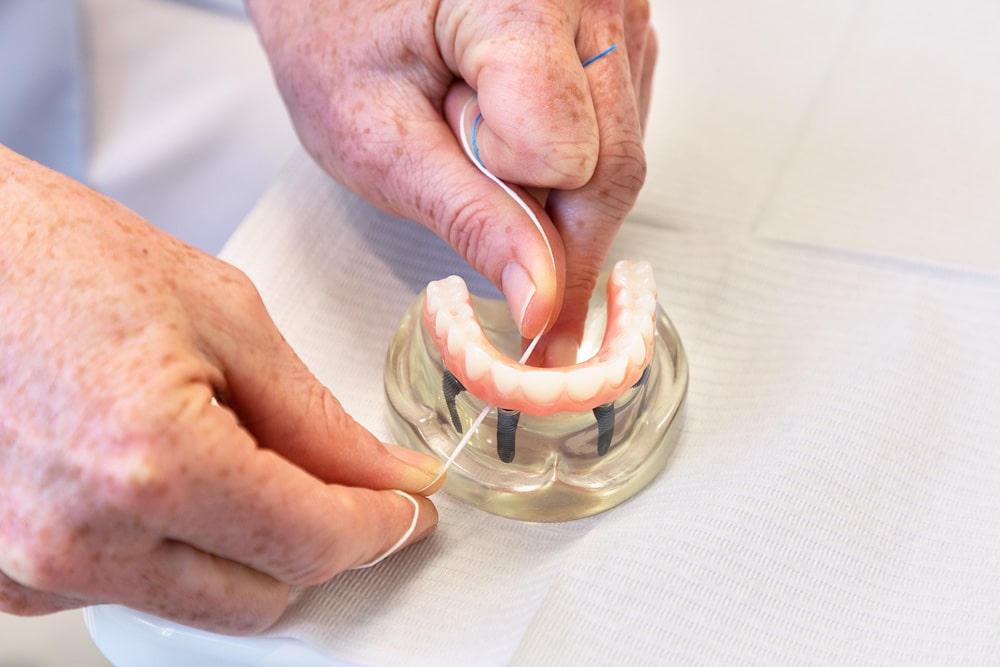 Hygiene Implant-Aftercare 4 Aftercare for dental implants with dental hygiene techniques.