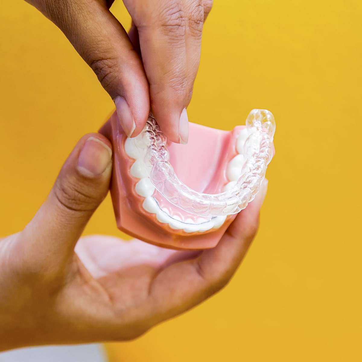 Invisilign Braces on model of teeth