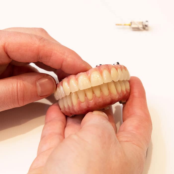 Advanced Dental Restorations