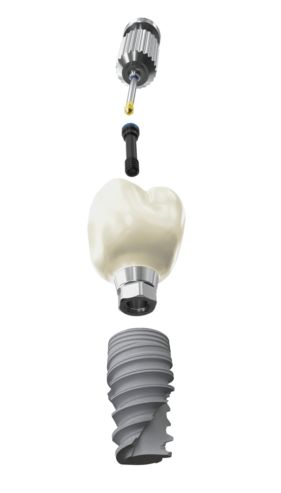 nobel dental implant solution