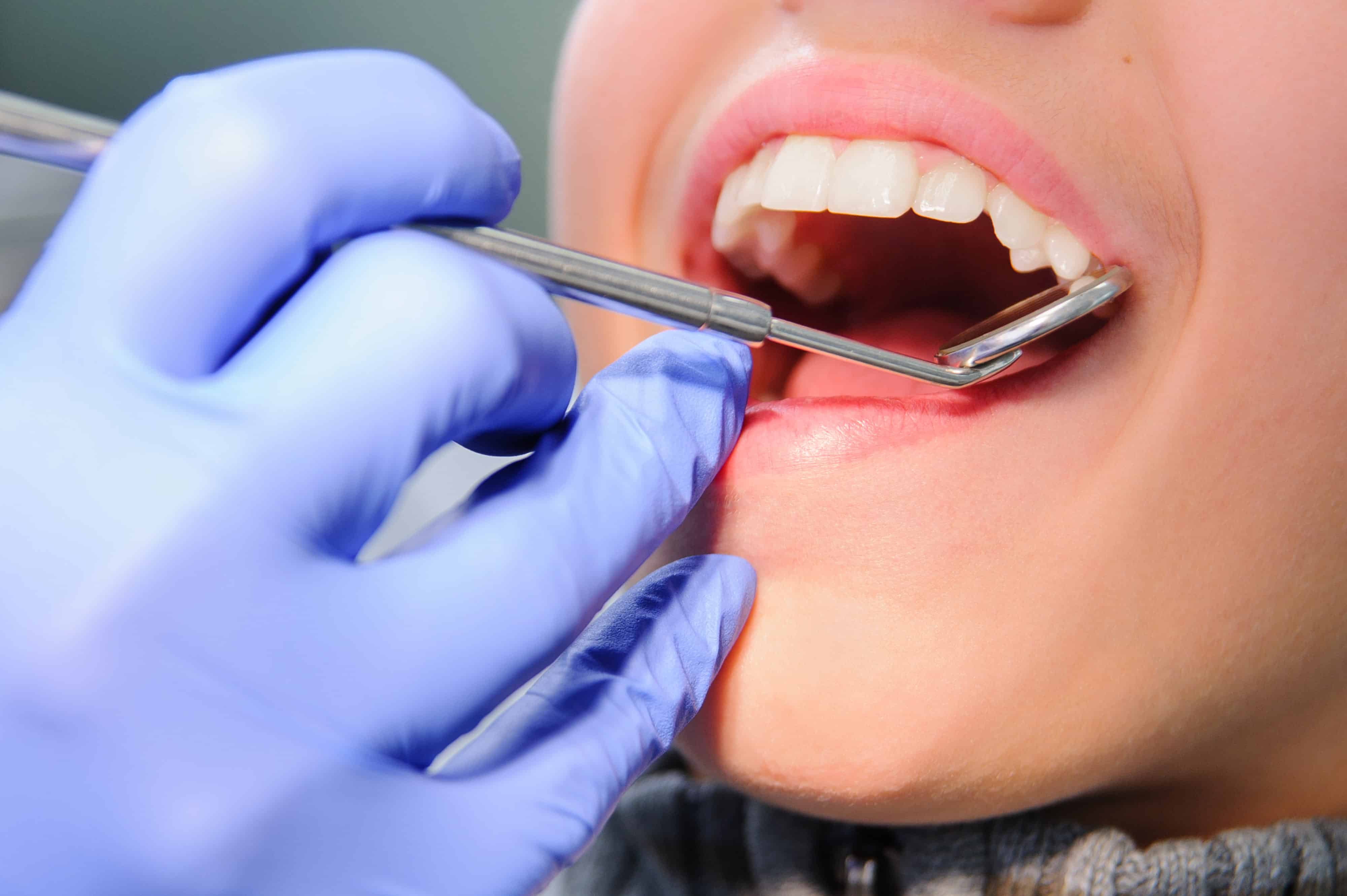 How often should I get a dental check-up to maintain my dental health?