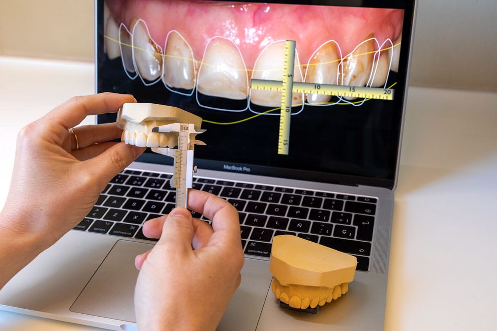 Smile-Design 4 Dentist at Dawood & Tanner’s Wimpole Street clinic in London measuring a model of a patient’s teeth, with digital smile design planning on a laptop in the background, providing advanced restorative and cosmetic treatments for natural results.