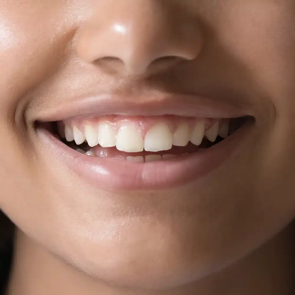 Dental-Hygiene-clean-teeth 2 Dental Hygiene clean teeth