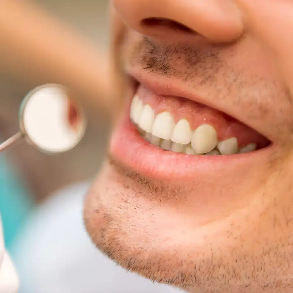 Hygiene-Gum-disease-treatment 3 Hygiene Gum disease treatment