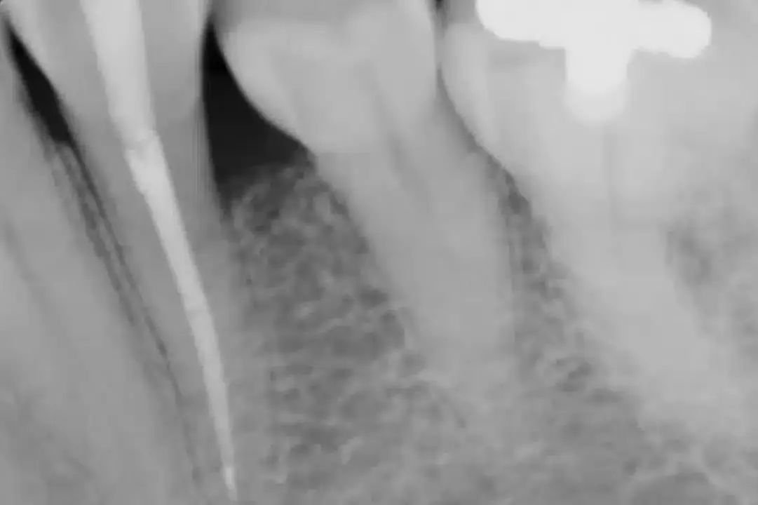 Regeneration of gum uai