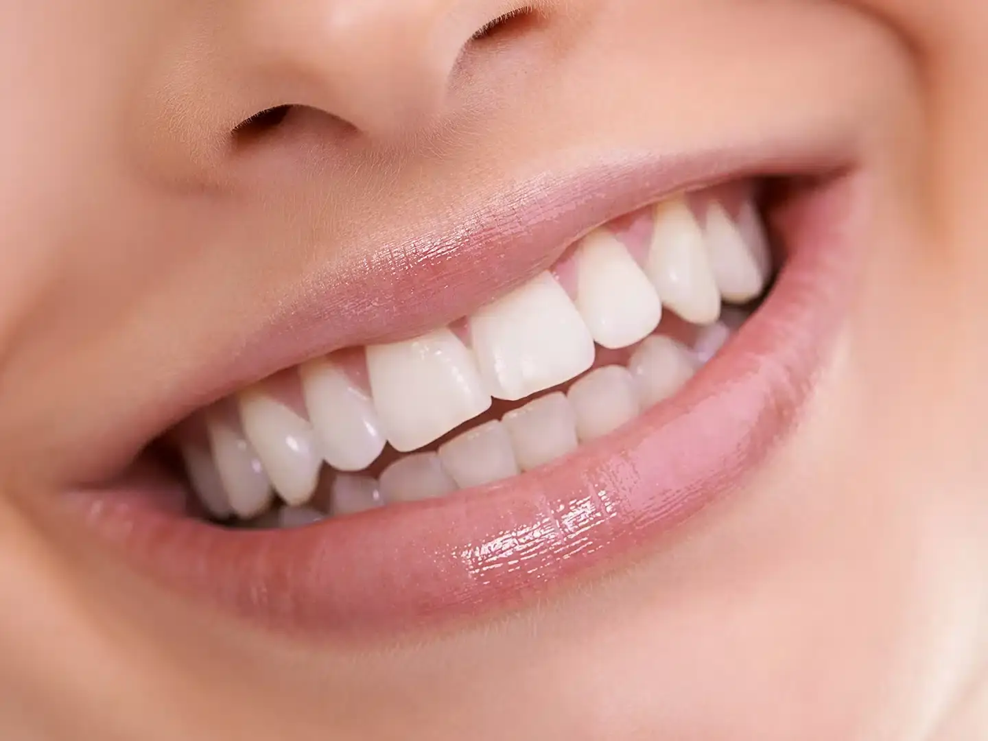 Natural, Not Perfect: The New Aesthetic in Cosmetic Dentistry 1 natural Looking Cosmetic Dentistry uai