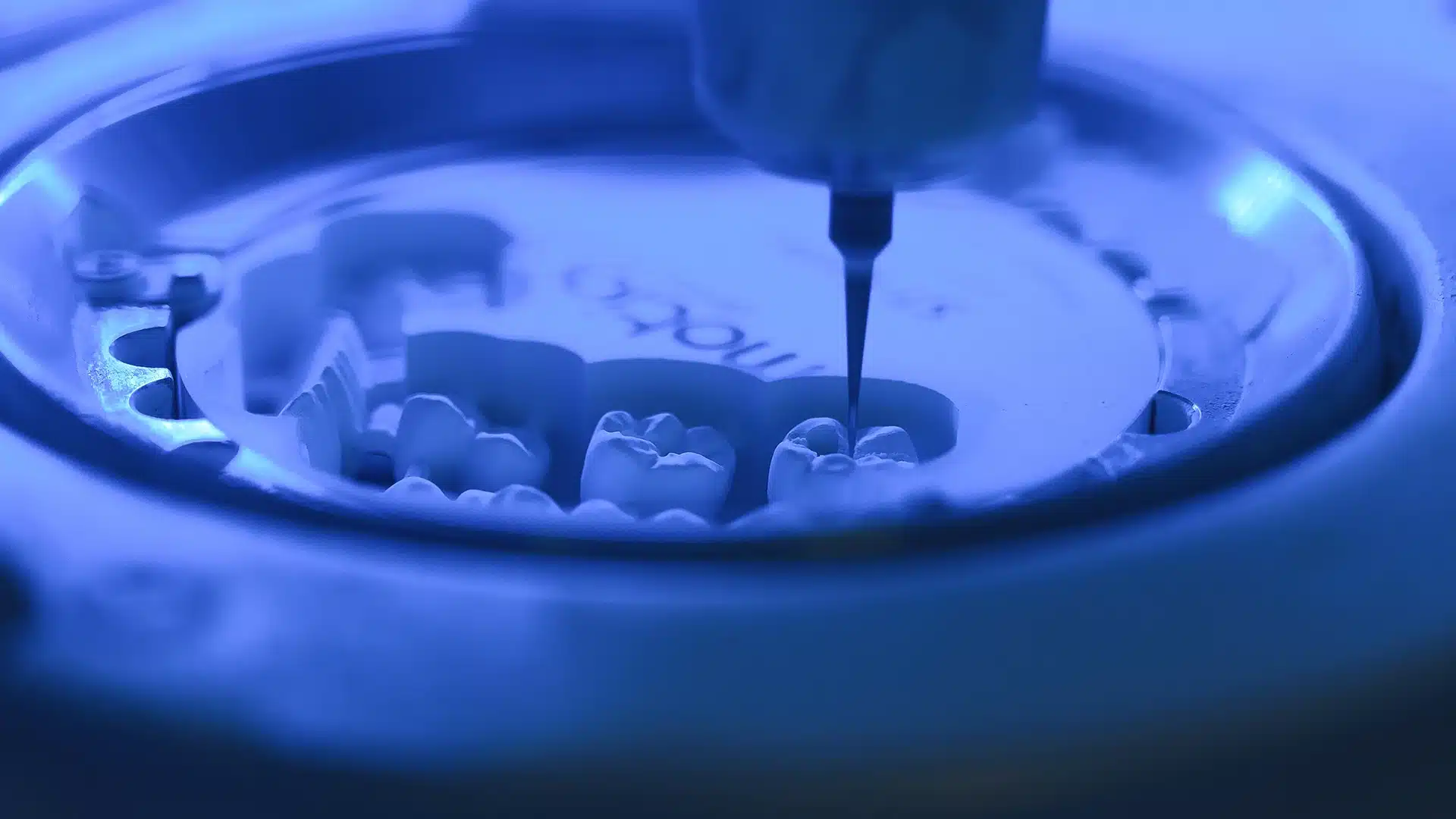 Digital Dentistry: Innovation Meets Expertise 5 Digital Dentistry Blog