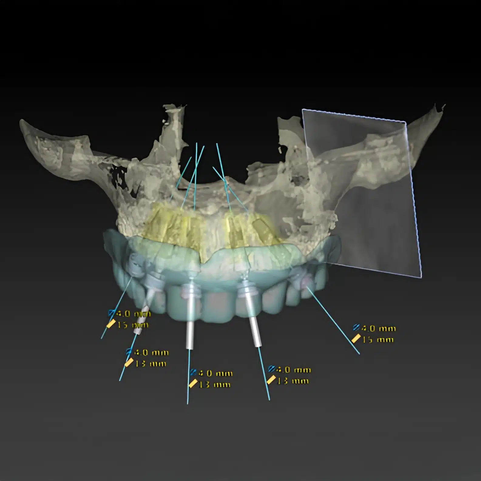 Image Guided Surgery 1 to1