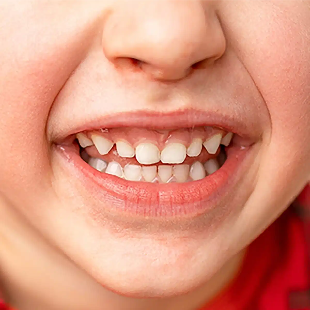 Baby teeth boy 1 Baby teeth boy