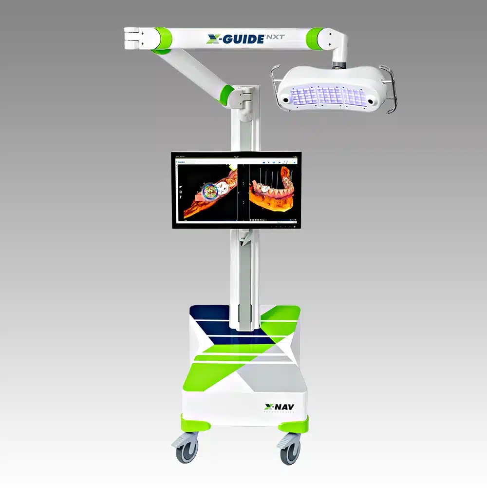 Real-Time Implant Navigation: X-Nav 5 X Guide